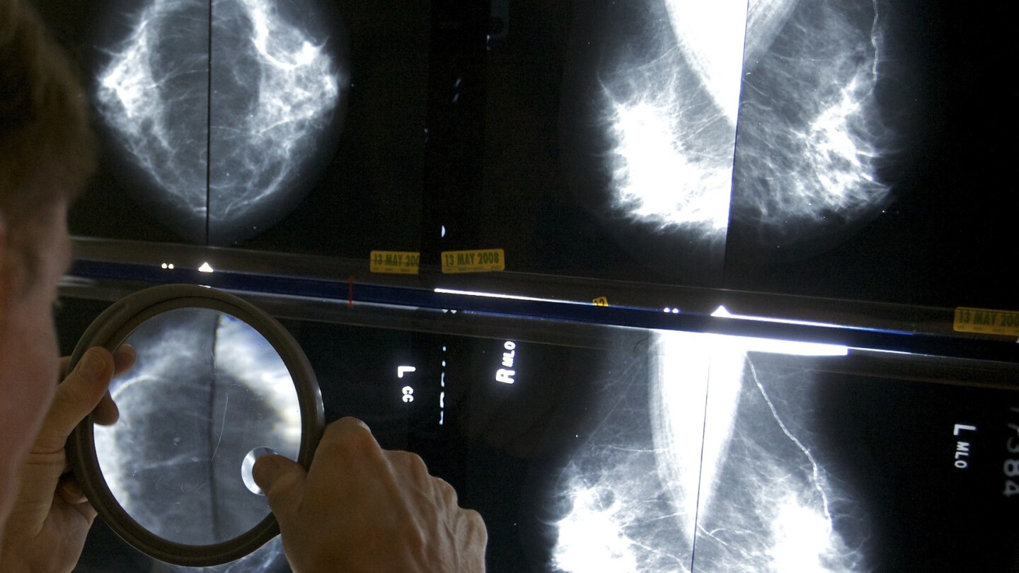 Мамографиите трябва да започват на 40 години, за да се отговори на нарастващите нива на рак на гърдата в по-млада възраст, казва групата
