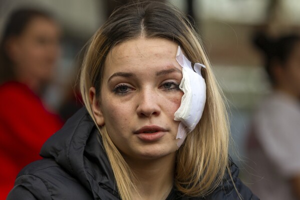 Maria Taseva, a 19 years-old survivor, who said her sister died in the fire, sits outside a hospital in the town of Kocani, North Macedonia, Sunday, March 16, 2025, following a massive fire in the nightclub early Sunday. (AP Photo/Visar Kryeziu)