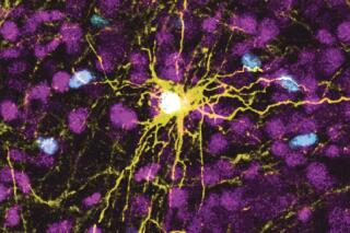 This microscope image provided by Pasca Lab/Stanford Medicine shows a human astrocyte cell, center in yellow, and human glial cells (scattered in blue) inside the brain of a rat. (Pasca Lab/Stanford Medicine via AP)