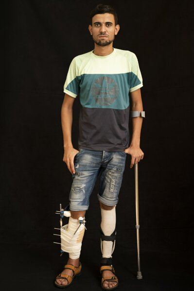 
              In this Sept. 19, 2018, photo, Mohammed al-Eissawi, 24, poses as he awaits treatment at a Gaza City clinic run by MSF (Doctors Without Borders). Al-Eissawi says he was throwing rocks with a slingshot when he was shot in the leg several times. He has been protesting for five years and has been injured many times. He says that he is not afraid and will continue to take part in protests. (AP Photo/Felipe Dana)
            