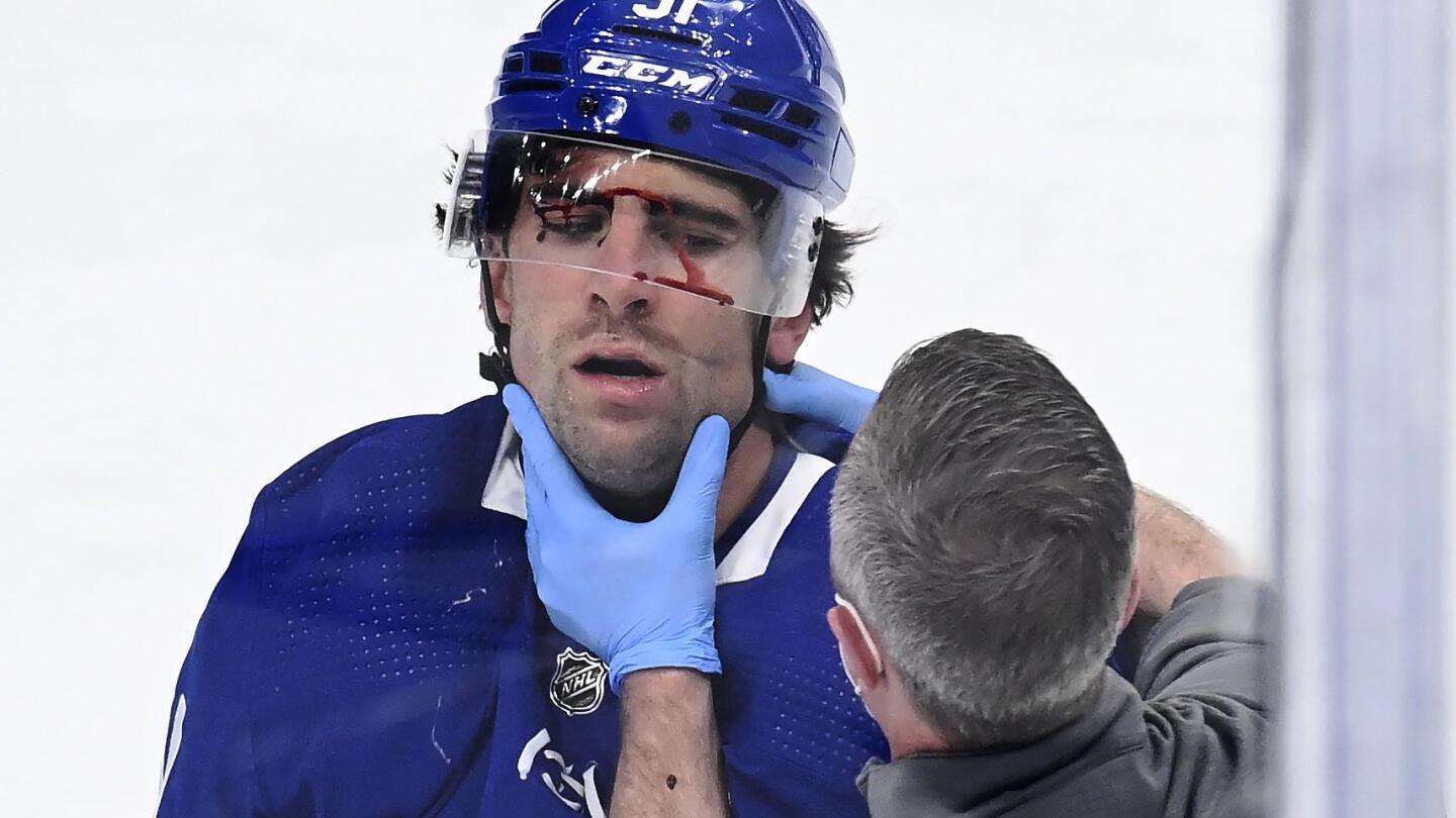 Maple Leafs' John Tavares cleared of structural damage to head, neck, spine