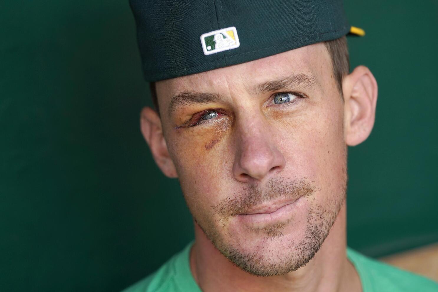 MLB Pitcher Chris Bassitt Injury After Hit by 100-Mph Line Drive