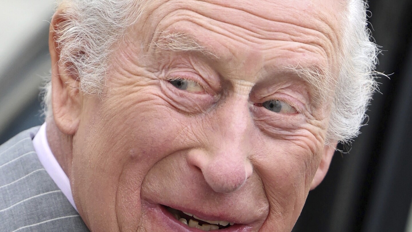 King Charles III experiences side effects after receiving medical treatment and is in hospital