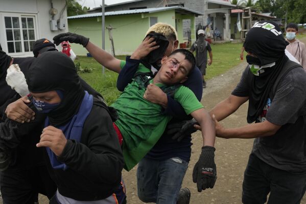 Men carry a fellow demonstrator injured during clashes with police at a protest against recent actions by President Jose Raul Mulino, including a pension reform law and a security agreement with the United States involving the Panama Canal, in Arimae, Panama, Thursday, June 5, 2025. (AP Photo/Matias Delacroix)