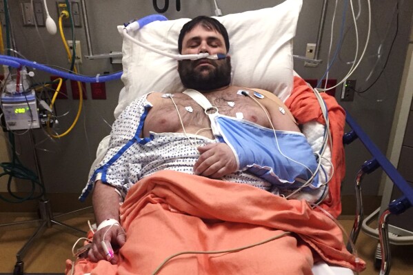 In this photograph provided by Kerry Smith, Jeffery Smith rests in a hospital bed after injuries sustained in a snowmobile crash at Baystate Medical Center, April 16, 2019, in Springfield, Mass. Jeffrey Smith has filed suit against the government to pay nearly $10 million after being badly injured in a snowmobile crash with a Black Hawk helicopter. Smith's snowmobile collided with a helicopter that was parked on a Massachusetts snow-covered trail at dusk. (Kerry Smith photo via AP)