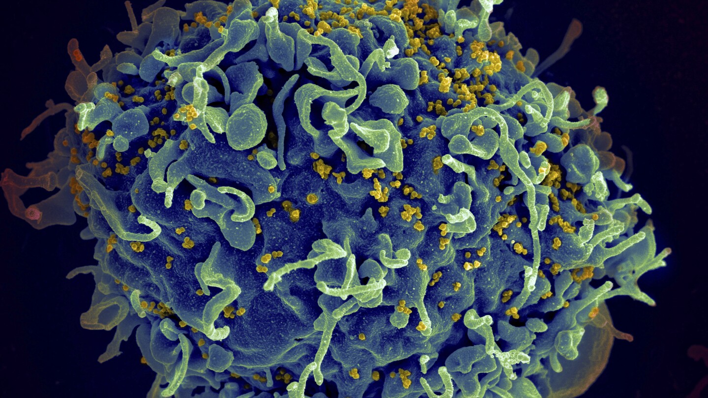 Три жени бяха диагностицирани с ХИВ след като получиха вампирски