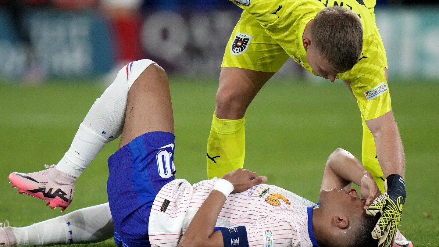 Kylian Mbappé sustained a broken nose at Euro 2024, but France gets ‘positive’ news