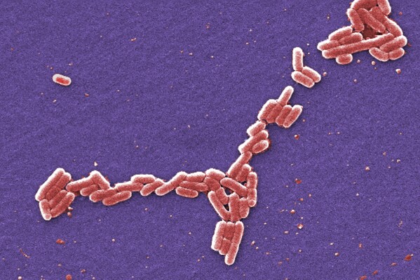 FILE - This colorized 2006 scanning electron microscope image made available by the Centers for Disease Control and Prevention shows E. coli bacteria of the O157:H7 strain that produces a powerful toxin which can cause illness. Health officials are investigating an outbreak of E. coli food poisoning among students at the University of Arkansas in late August 2023, with dozens reporting symptoms and several needing treatment in the hospital. (Janice Haney Carr/CDC via AP, File)