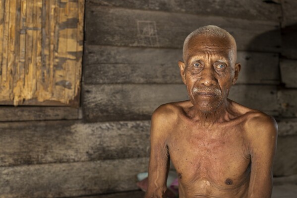 Ilyas, 70, who has been complaining of itchy skin rashes, sits for a photograph at his house on Kabaena Island near nickel mining activities in Indonesia, Friday, Nov. 15, 2024. (AP Photo/Yusuf Wahil)