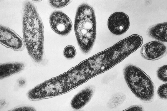 FILE - This 1978 electron microscope image made available by the Centers for Disease Control and Prevention shows Legionella pneumophila bacteria which are responsible for causing the pneumonic disease Legionnaires' disease. Poland's internal security officers were searching for the source of a deadly outbreak of Legionnaires' disease which has killed seven people and infected more than 100 others in the strategic city of Rzeszow, near the border with Ukraine, authorities said Friday Aug. 25, 2023. (Francis Chandler/CDC via AP, File)