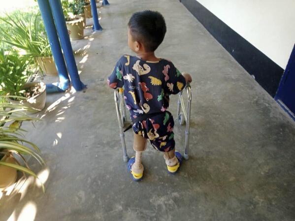In this photo provided by the family, a young landmine victim learns to use his new prosthetic limbs at Hpa-An Orthopedic Rehabilitation Center in Hpa-An township, Karen State, Myanmar, on Dec. 7, 2022. The boy lost his legs in a landmine blast in July 2022. He speaks frequently about the blast, but his mother isn't sure he'll ever process what happened. “Maybe he still doesn’t understand,” she said. “He is still young.” (Family photo via AP)