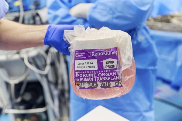 Gene-edited pig kidneys will be removed from the package in the operating room of NYU Langone Health in New York on November 25, 2024 (Joe Carrotta of Nyu Langone Health via the AP)