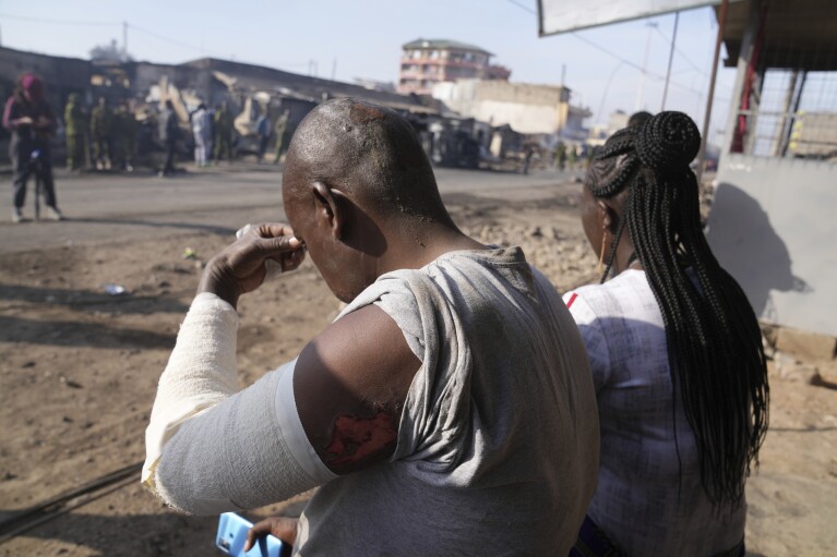 Den skadade Alfred Juma sitter framför sitt hem nära platsen för en explosion i Nairobi, Kenya, fredagen den 2 februari 2024. (AP Photo/Brian Inganga)