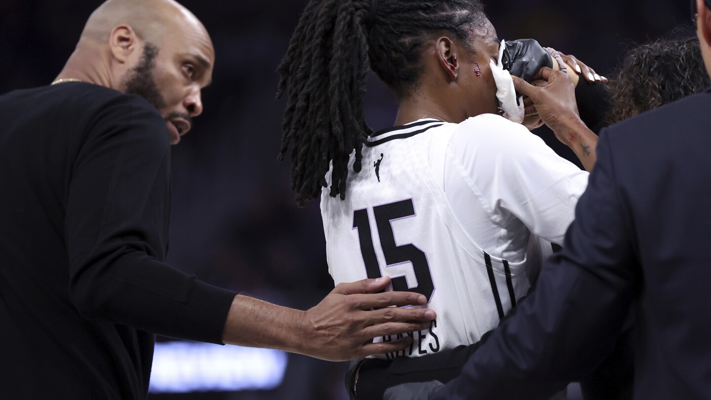 Valkyries guard Tiffany Hayes helped off court after being hit in the