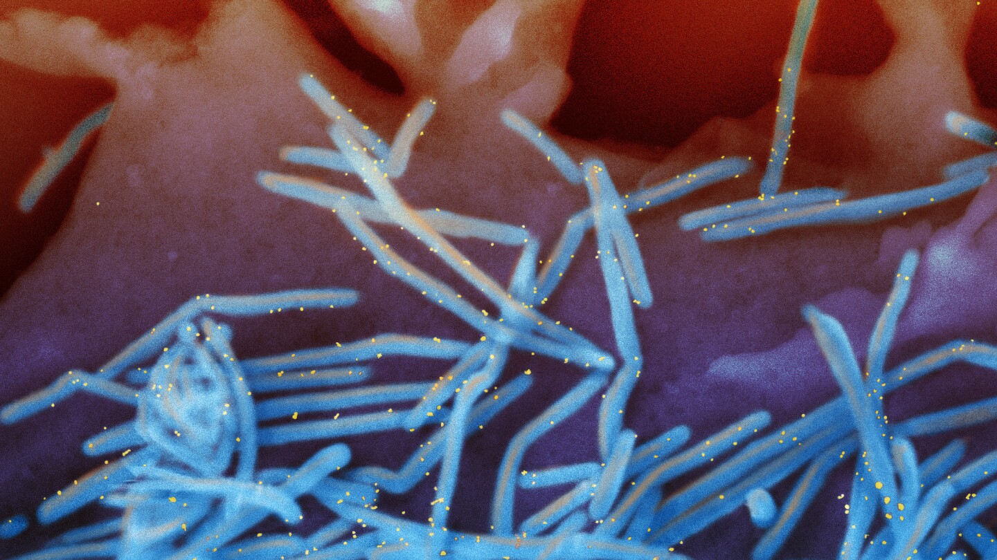 Officials investigate rare nervous system disorder in older adults who got RSV vaccine