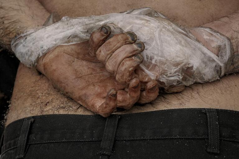 The body of a man who was killed with his hands tied behind his back lies on the ground in Bucha, Ukraine, Sunday, April 3, 2022. (AP Photo/Vadim Ghirda)