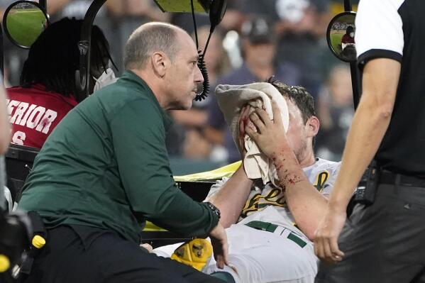 Chris Bassitt: Oakland A's pitcher needs surgery on fractured