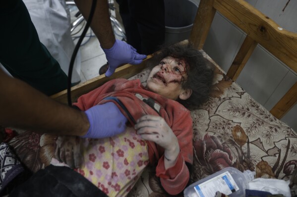 A Palestinian child wounded in the Israeli bombardment of the Gaza Strip is treated in Khan Younis on Friday, Dec. 8, 2023. (APPhoto/Mohammed Dahman)