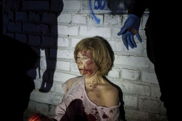 An injured woman sits near her house, which was damaged by a Russian airstrike, in a residential neighbourhood in Kyiv, Ukraine, on Thursday, April 24, 2025. (AP Photo/Evgeniy Maloletka)