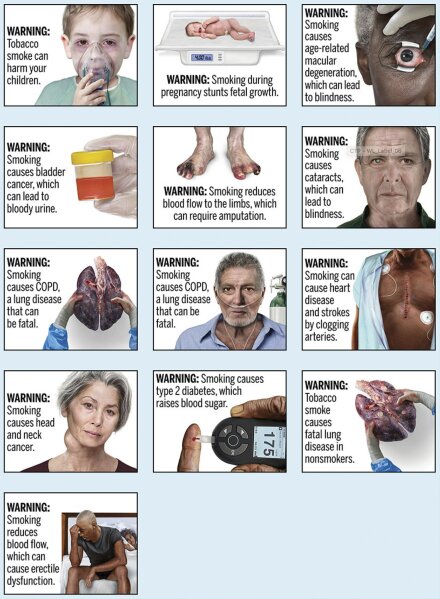 This image provided by the U.S. Food and Drug Administration on Thursday, Aug. 15, 2019 shows proposed cigarette warning labels. On Thursday, the agency announced a new attempt to place graphic warnings on all cigarettes to discourage Americans from smoking. The new effort comes more than seven years after a previous proposal was defeated in court. (FDA via AP)