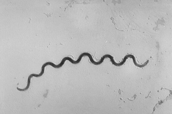 FILE - This 1972 microscope image provided by the Centers for Disease Control and Prevention shows a Treponema pallidum bacterium which causes the disease syphilis. With syphilis cases in U.S. newborns skyrocketing, a doctors group is now recommending that all pregnant women be screened three times for the sexually transmitted infection. The American College of Obstetricians and Gynecologists issued updated its guidance to doctors on Thursday, April 18, 2024. (Susan Lindsley/CDC via AP)