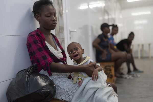 FILE - A malnourished child waits to be treated at a Doctors Without Borders emergency room in the Cite Soleil neighborhood of Port-au-Prince, Haiti, Friday, April 19, 2024. Haiti's health system has long been fragile, but it's now nearing total collapse after gangs launched coordinated attacks on Feb. 29, targeting critical state infrastructure in the capital and beyond. (AP Photo/Ramon Espinosa, File)