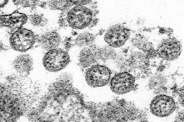 This 2020 electron microscope made available by the U.S. Centers for Disease Control and Prevention image shows the spherical coronavirus particles from the first U.S. case of COVID-19. Released by the CDC on Friday, July 31, 2020, a Georgia summer camp hit by a coronavirus outbreak took many precautions, but didn’t make campers wear masks and put too many children in the same cabin, according to a government report released Friday. (C.S. Goldsmith, A. Tamin/CDC via AP)