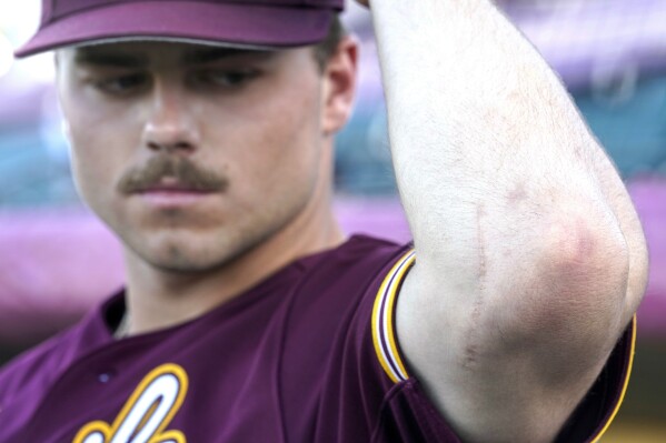 Arizona State University NCAA college baseball player Brandon Compton shows his Tommy John surgery scar before their game against Oregon in Phoenix, Saturday, March 9, 2024. (AP Photo/Darryl Webb)