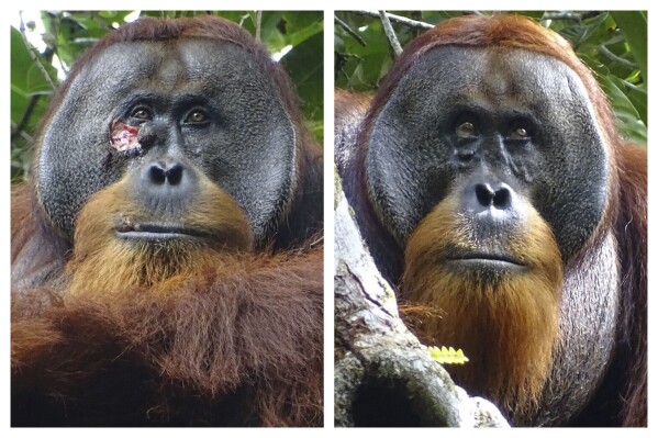 This combination of photos provided by the Suaq foundation shows a facial wound on Rakus, a wild male Sumatran orangutan in Gunung Leuser National Park, Indonesia, on June 23, 2022, two days before he applied chewed leaves from a medicinal plant, left, and on Aug. 25, 2022, after his facial wound was barely visible. (Armas, Safruddin/Suaq foundation via AP)