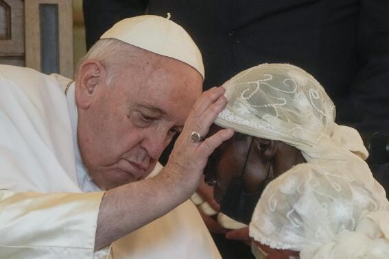 Pope Francis caresses a victim of violence in eastern Congo, at the Apostolic Nunciature in Kinshasa, Democratic Republic of Congo, Wednesday, Feb. 1, 2023. Francis is in Congo and South Sudan for a six-day trip, hoping to bring comfort and encouragement to two countries that have been riven by poverty, conflicts and what he calls a "colonialist mentality" that has exploited Africa for centuries. (AP Photo/Gregorio Borgia)