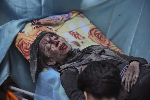 A Palestinian wounded in Israeli bombardment waits for treatment in a hospital in Deir al-Balah, southern Gaza Strip, Friday, Oct. 20, 2023. (AP Photo/Hatem Moussa)