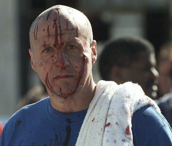 An unidentified man, his face covered with blood, looks at the bombed Alfred P. Murrah Federal Building in Oklahoma City on April 19, 1995. (AP Photo/David Longstreath, File)