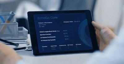 EchoGo Core on tablet (PRNewsfoto/Ultromics)