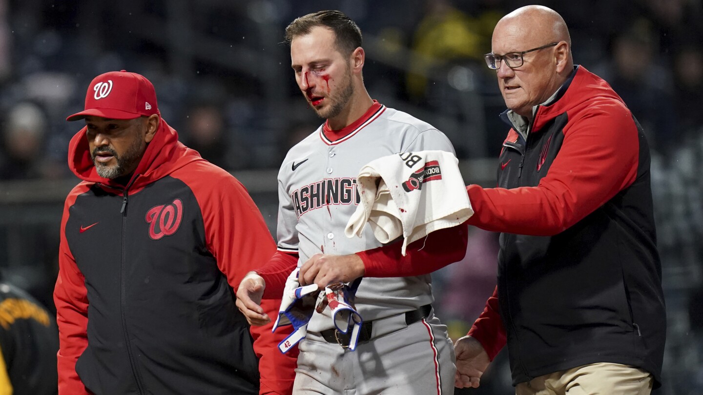 Nats' Paul DeJong relieved his vision wasn't affected by pitch to face that broke multiple bones