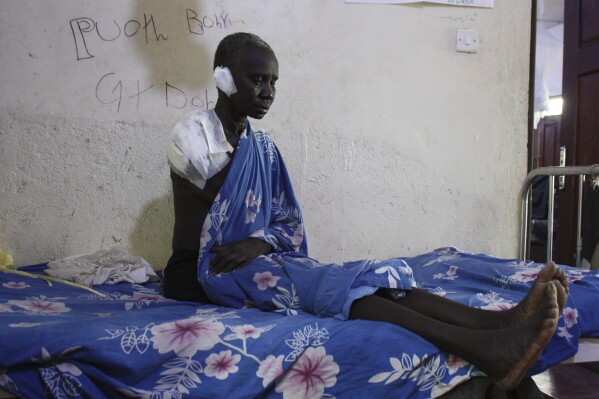 Wiyuach Makuach, 60, who lost her arm in an airstrike on a hospital operated by Doctors Without Borders (MSF), sits in a hospital bed in Akobo, South Sudan, Sunday, May 25, 2025. (AP Photo/Joseph Falzetta)