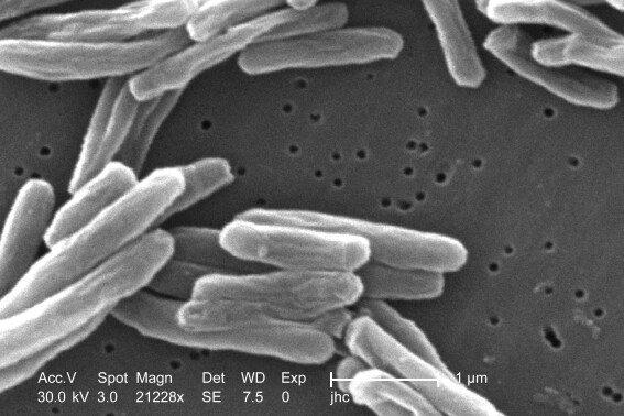 This 2006 electron microscope image provided by the Centers for Disease Control and Prevention shows Mycobacterium tuberculosis bacteria, which causes the disease tuberculosis. The number of U.S. tuberculosis cases in 2023 was the highest in a decade, according to a report released by the CDC on Thursday, March 28, 2024. (Janice Carr/CDC via AP)