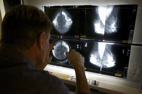 FILE - In this May 6, 2010 file photo, a radiologist checks mammograms in in Los Angeles. Women who use certain types of hormones after menopause still have an increased risk of developing breast cancer nearly two decades after they stop taking the pills, long-term results from a big federal study suggest. (AP Photo/Damian Dovarganes, File)
