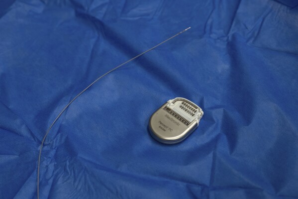 A sample pacemaker-like device, used for deep brain stimulation therapy, and its electrodes which are implanted into a specific site in the brain are displayed at Mount Sinai West in New York on Dec. 20, 2023. The device controls the amount of electrical stimulation to the brain and delivers constant low-voltage pulses. Patient Emily Hollenbeck calls it “continuous Prozac.” (AP Photo/Mary Conlon)
