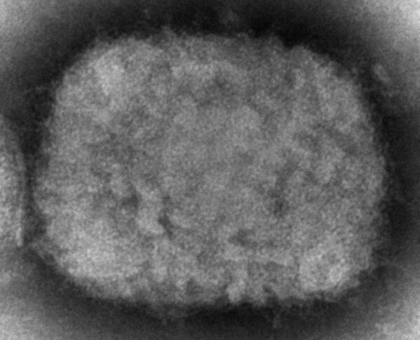 FILE - This 2003 electron microscope image made available by the U.S. Centers for Disease Control and Prevention shows a monkeypox virion, obtained from a sample associated with the 2003 prairie dog outbreak. Two children have been diagnosed with monkeypox in the United States: a toddler in California and an infant who is not a U.S. resident, health officials said Friday, July 22, 2022. (Cynthia S. Goldsmith, Russell Regner/CDC via AP, File)