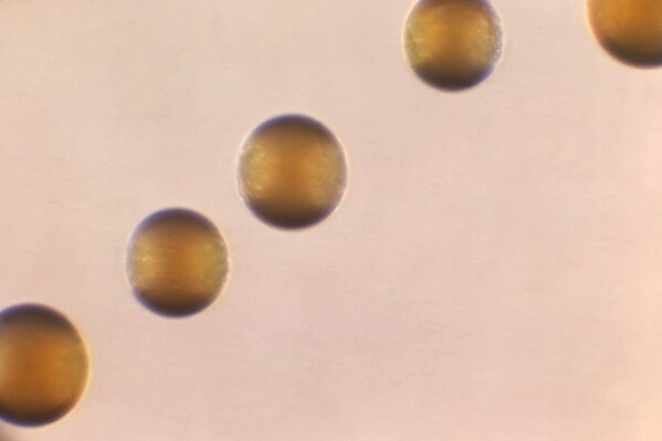 This 1966 microscope photo shows five colonies of Group-B Neisseria meningitidis bacteria. On Thursday, March 28, 2024, the CDC issued an alert to U.S. doctors about an increase in cases of one type of invasive meningococcal disease, mostly due to the serogroup Y strain of the bacteria. Four hundred and twenty two cases were reported in 2023, which was the most in a single year since 2014. There have been 143 reported this year so far. (Dr. Brodsky/CDC via AP)