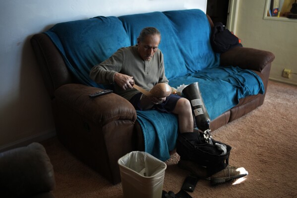 Blas Sanchez prepares to put on a prosthetic Friday, Jan. 26, 2024, in Winslow, Ariz.Sanchez's leg was mutilated while working near the chicken manure chute as a prison laborer at Hickman's Family Farms in 2015 in Tonopah, Ariz. (AP Photo/John Locher)