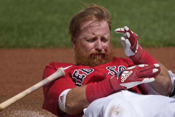 Justin Turner of Red Sox hit in the face by pitch
