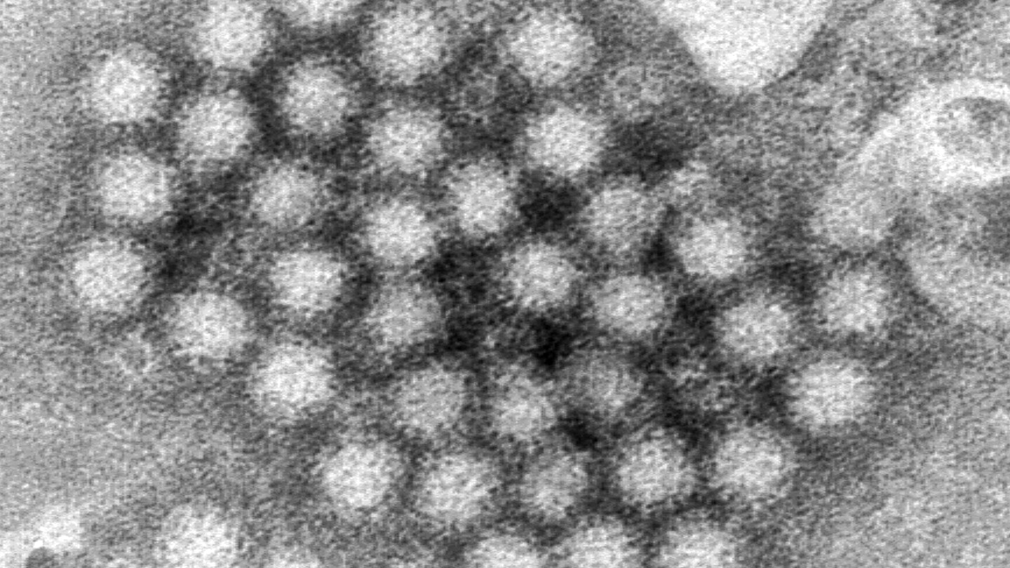 Норовирусните заболявания се увеличават на някои места. Ето какво трябва да знаете