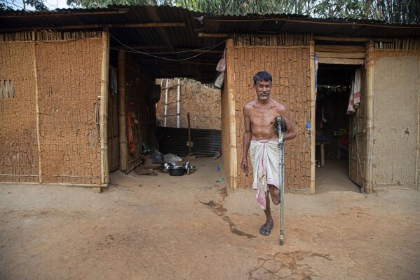 In this March 31, 2020, photo, Paresh Talukdar who lost his leg and a hand stands outside his hut in a village Jayantipur in eastern Indian state of Assam. Talukdar supports a family of five on the $2.50 or so he makes in a day by begging. India has launched one of the most draconian social experiments in human history, locking down its entire population, including hundreds of millions of people who struggle to survive on a few dollars a day. (AP Photo/Anupam Nath)