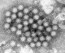 This electron microscope image provided by the Centers for Disease Control and Prevention shows a cluster of norovirus virions. On Thursday, Feb. 29, 2024, the Centers for Disease Control and Prevention said that cases of norovirus, a nasty stomach bug that spreads easily, are climbing in the Northeastern U.S. (Charles D. Humphrey/CDC via AP)