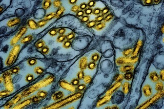 This colorized electron microscope image released by the National Institute of Allergy and Infectious Diseases on March 26, 2024, shows avian influenza A H5N1 virus particles (yellow), grown in Madin-Darby Canine Kidney (MDCK) epithelial cells (blue). (CDC/NIAID via AP)