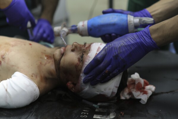 A wounded Palestinian child receives medical treatment at the Nasser Hospital following Israeli bombardment on Khan Younis refugee camp, southern Gaza Strip, Monday, Nov. 20, 2023. (AP Photo/Mohammed Dahman)