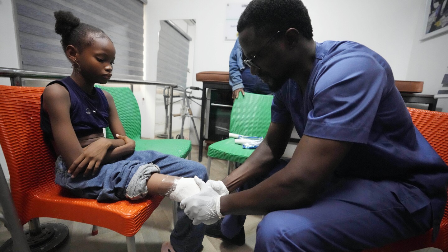 ЛАГОС Нигерия AP — Инцидентът който счупи десния крак на