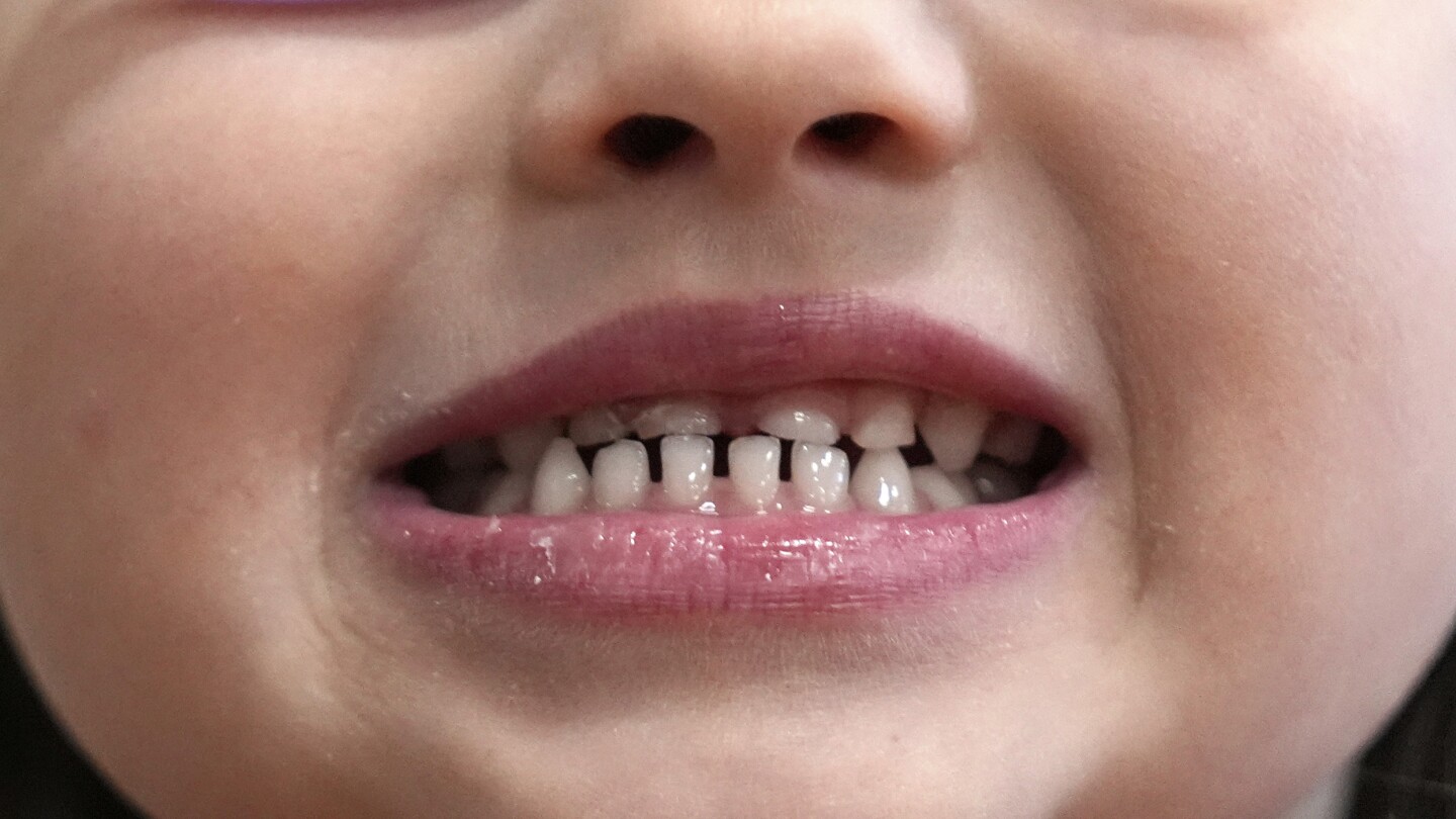 FDA and RFK Jr. aim to remove ingestible fluoride products used to protect kids' teeth