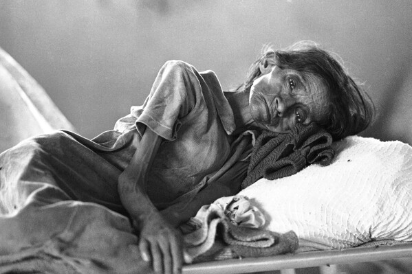 FILE - A Guatemalan woman, showing signs of severe malnutrition, lies on a cot at a makeshift clinic in a refugee camp on the outskirts of China, Mexico, near the border with Guatemala, July 7, 1984. Pat Hamilton, a combat veteran of the Vietnam War who covered the civil wars in Central America as a photojournalist for The Associated Press, and who later worked at Reuters covering the Gulf War in Iraq, died Sunday, Aug. 13, 2023, after a long struggle with cancer. He was 74. (AP Photo/Pat Hamilton, File)